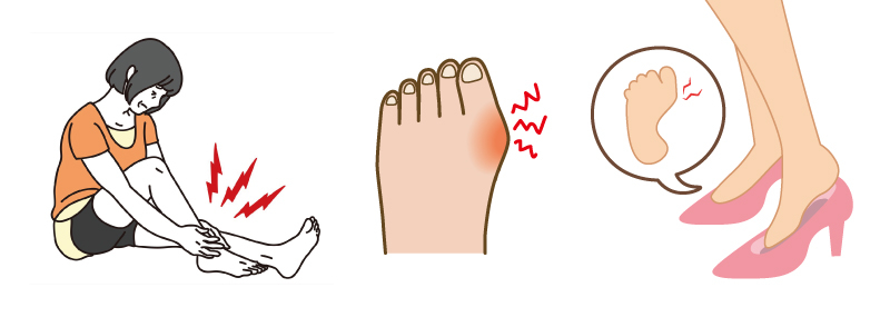 外反母趾の症状